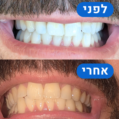 The Magic Powder - האבקה שגם מלבינה וגם מגנה על בריאות הפה