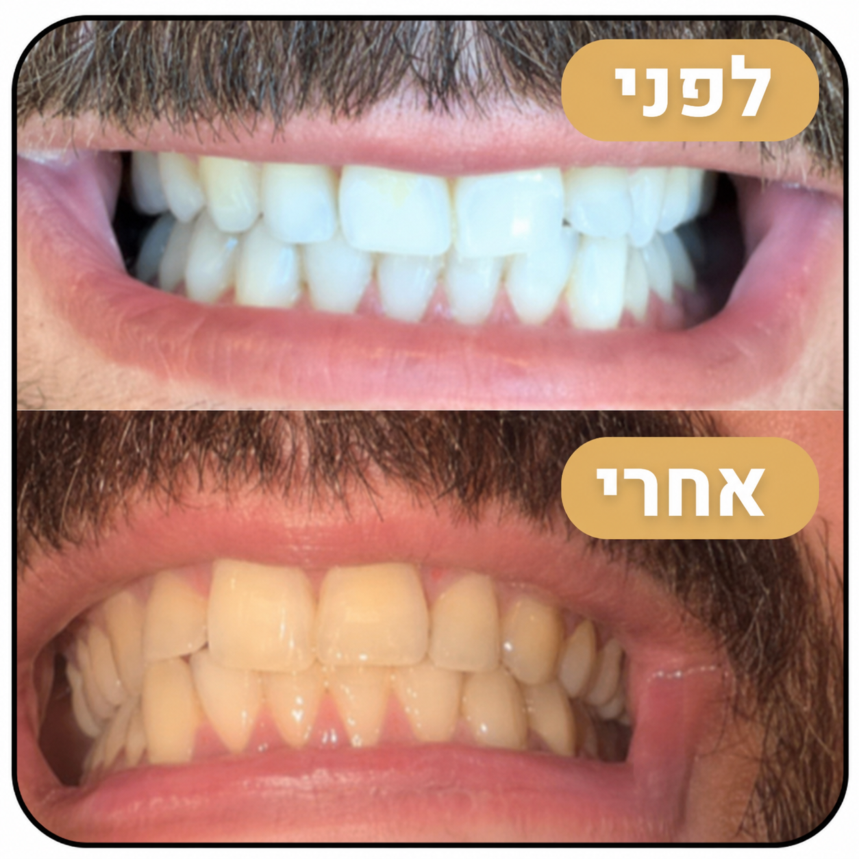 מארז ההלבנה Miswak - הלבנה טבעית ללא כימיקלים כבר מהשימוש הראשון