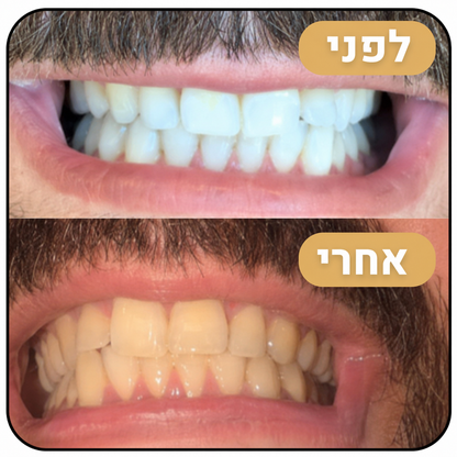 מארז ההלבנה Miswak - הלבנה טבעית ללא כימיקלים כבר מהשימוש הראשון